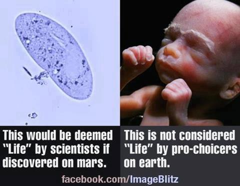unborn life.jpg